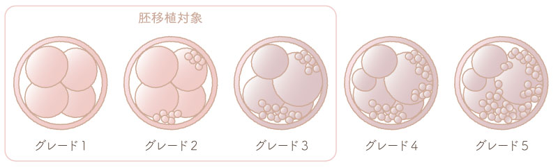 初期胚のグレード